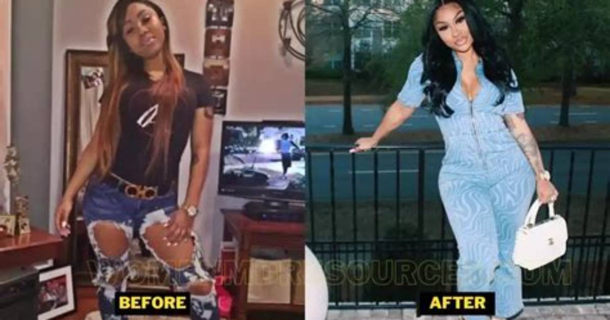 Ari Fletcher Before and After