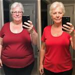 Atkins Estimond Weight Loss Before and After; Family and Net Worth