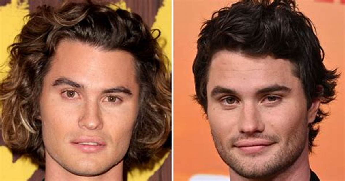 Chase Stokes Before Plastic Surgery Before and After Photos of the Outer Banks Stars!