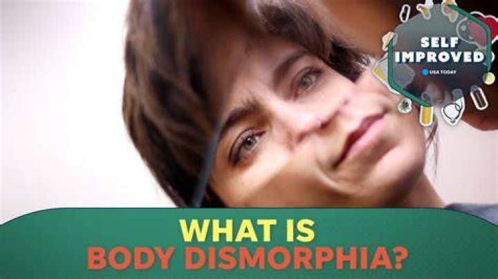 
“Death Of Mr Ugly” The Sun Article Draws Criticism Over Body Dysmorphia Case 