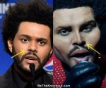 Did the Weeknd Get Plastic Surgery? Find out Here ·