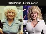 Dolly Parton and Her Iconic Breast Implants: a Journey Through Fame