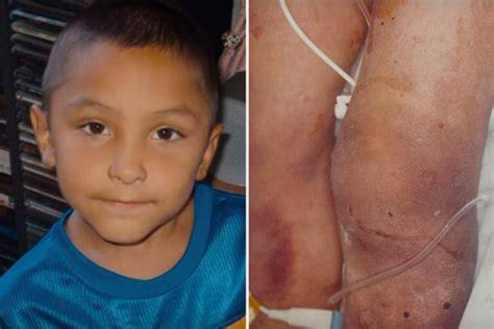 Gabriel Fernandez Autopsy Report, How Did He Die? Age Siblings And Family