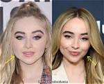 Has Sabrina Carpenter Had Plastic Surgery? the Truth Revealed