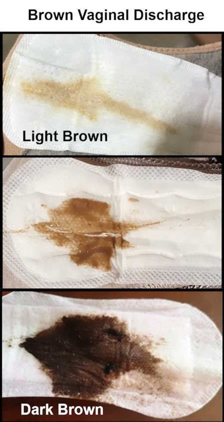 Is this brown stuff in my undies my period?