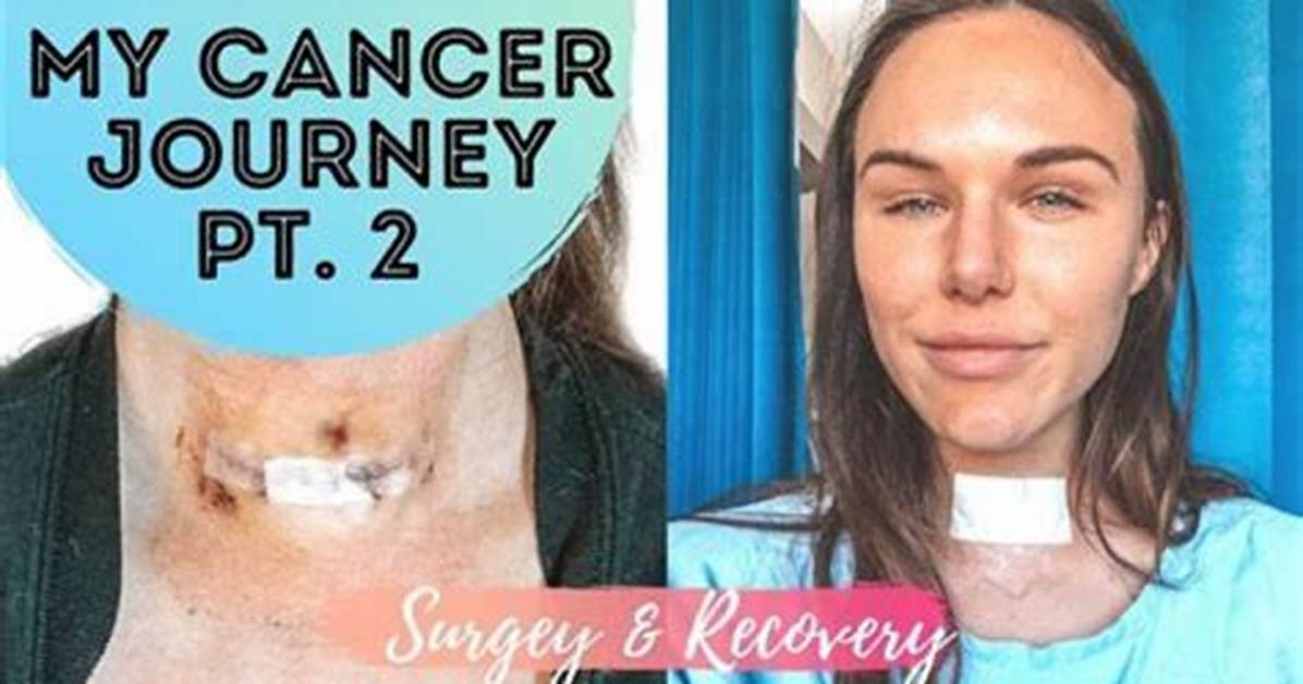Joyce Vance Tackles Thyroid Journey: Inspiring Insights and Support