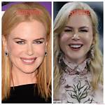Nicole Kidman Procedures: a Comprehensive Look at Her Beauty Transformations