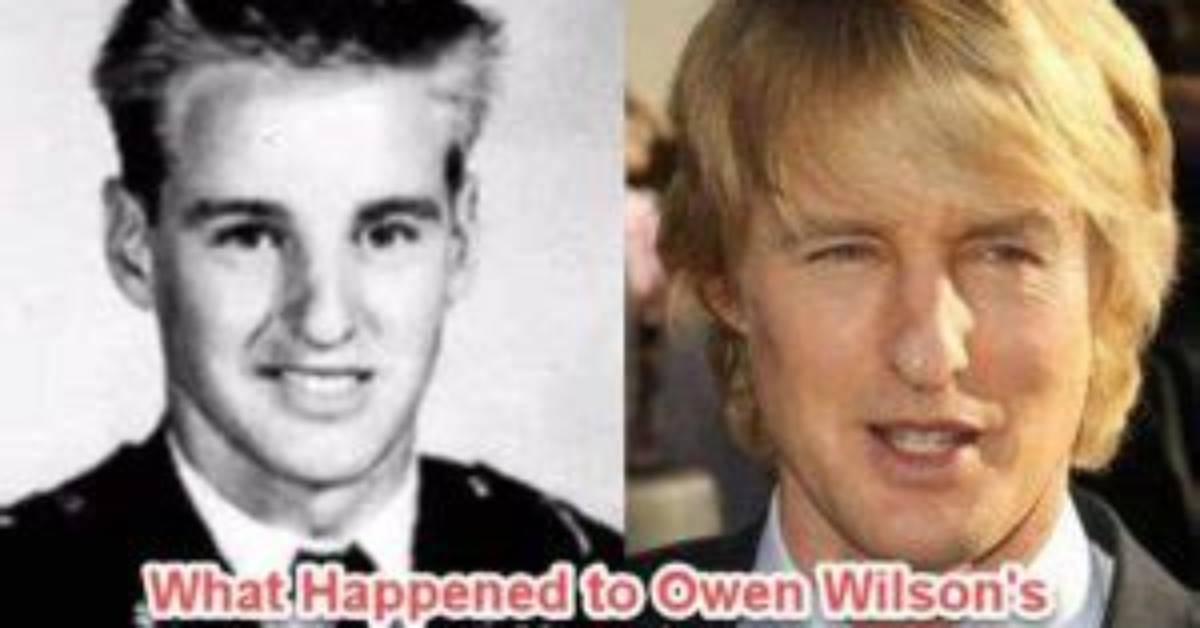 Owen Wilson's Nose: the Story Behind His Distinctive Feature