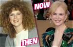 Post-Surgery Transformation: Nicole Kidman Unveils Her Renewed Appearance