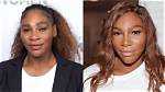 Serena Williams Plastic Surgery: Unveiling the Truth Behind the Rumors