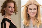 The Truth About Nicole Kidman's Freckles: Does She Have Them?