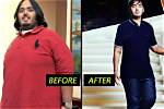 Transformative Journey: Anant Ambani's Weight Loss Surgery