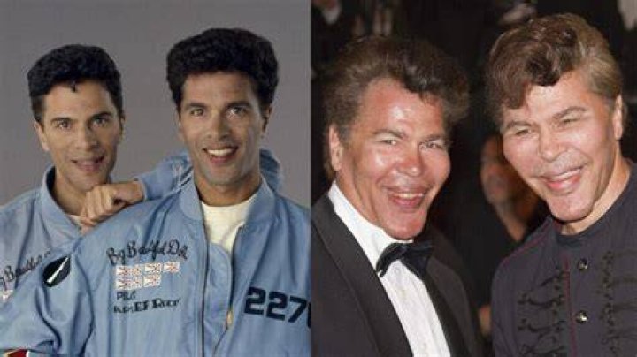 Twin Brothers Igor And Grichka Bogdanoff Before Plastic Surgery