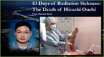 Unraveling the Tragic Tale of Hisashi Ouchi: a Victim of Nuclear Mishap