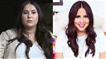 Unveiling Claudia Oshry's Chin Surgery Journey: Before and After