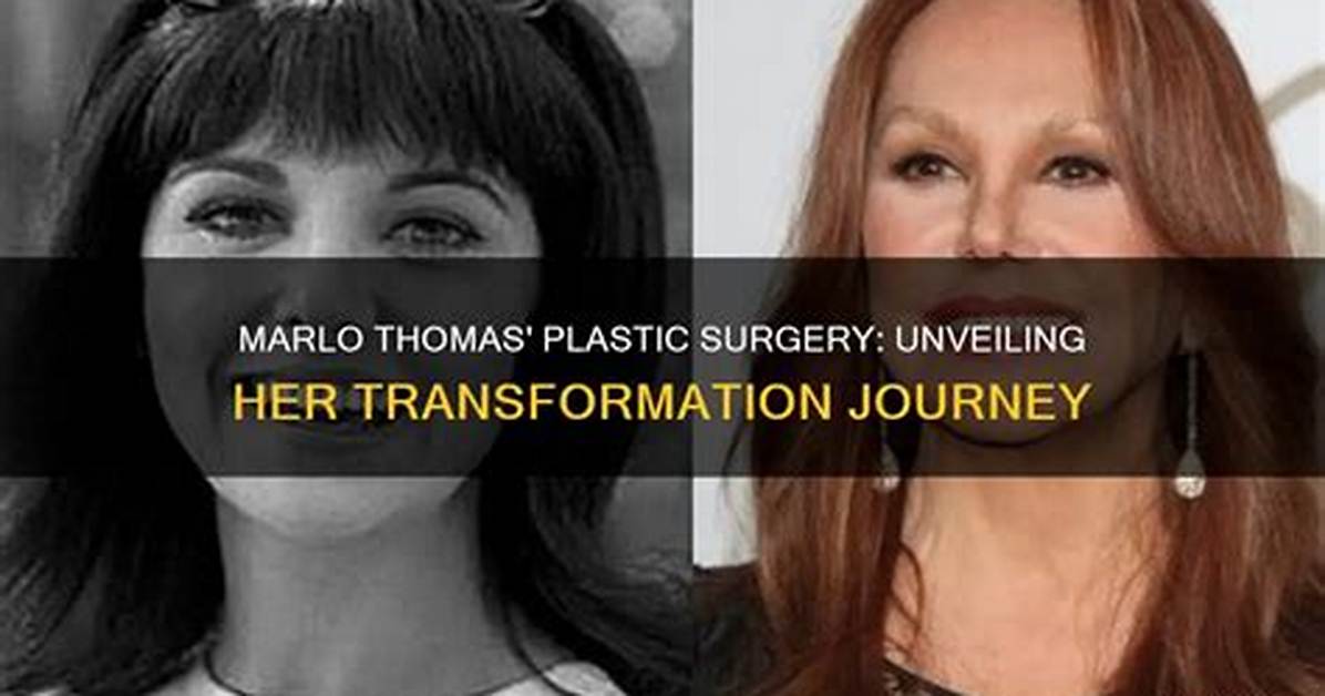 Unveiling the Journey and Impact of Marlo Kelly
