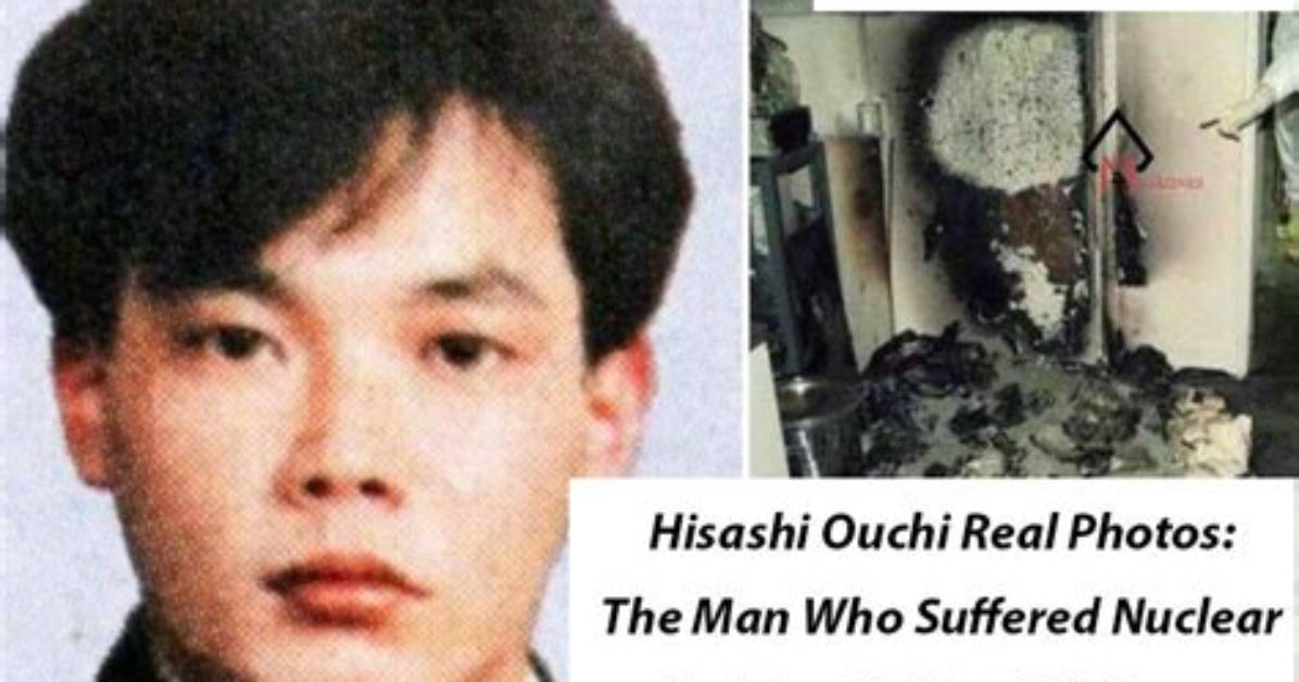 Unveiling the Reality: Hisashi Ouchi's Real Photo Body
