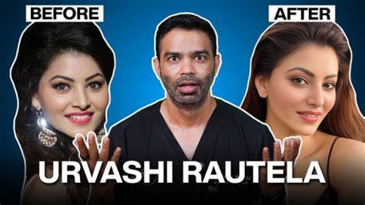 
Urvashi Rautela Plastic Surgery Before And After: No Makeup Look Viral On Tiktok 