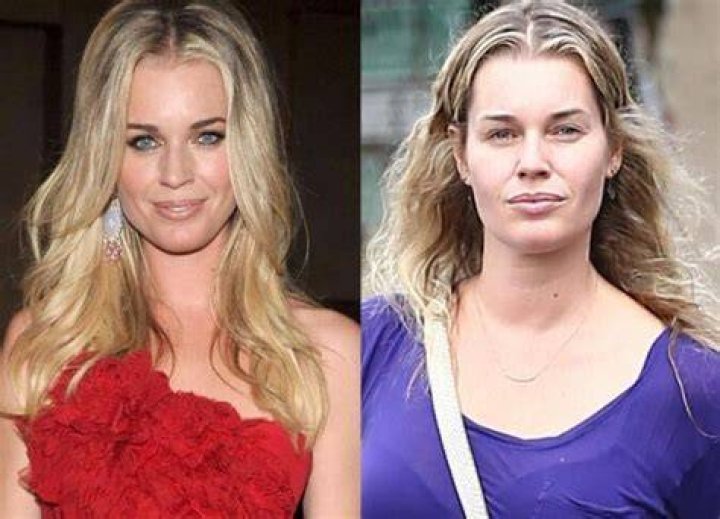 What Did Rebecca Romijn Do To her Face? Plastic Surgery Before And After, Net Worth