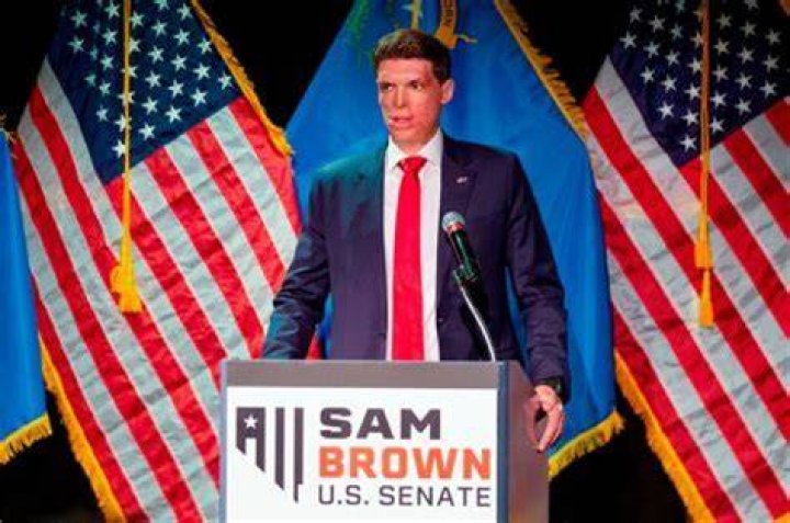 
What Happened To Sam Brown Nevada Face? US Senate Candidate Is A Former Soldier 