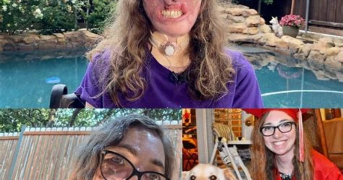 Where Is Jacqueline Durand in 2022? Dr Justin Bishop Dog Attack Victim Today