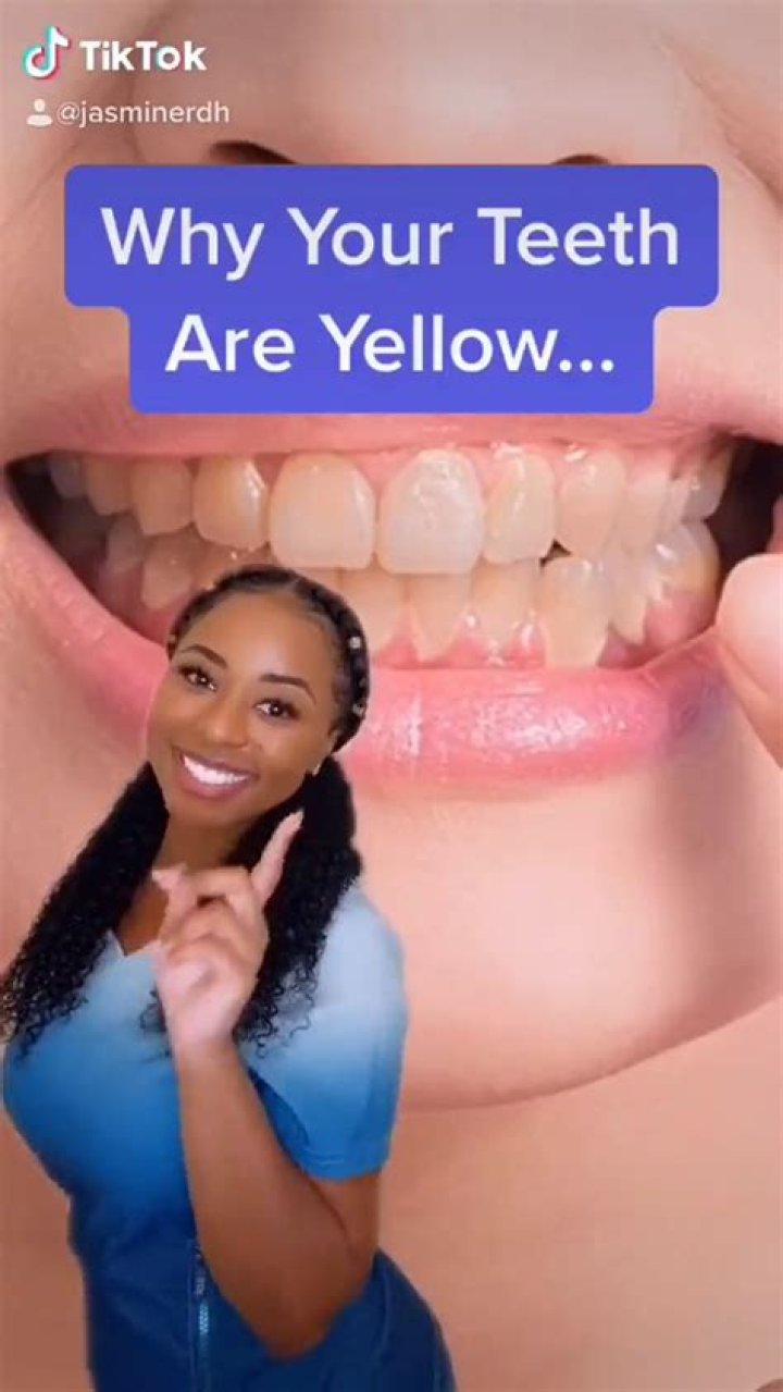 
Who Is Yellow Teeth Girl On TikTok? Reddit Reaction And Photos 